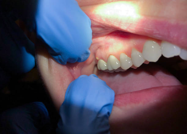 Best After-Hours Emergency Dentist in Lorton, VA